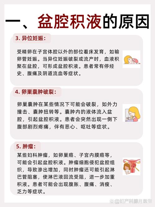 孕期宫腔积液多久能排完?-第1张图片-郑州医学网 孕期宫腔积液多久能排完?-第1张图片-郑州医学网