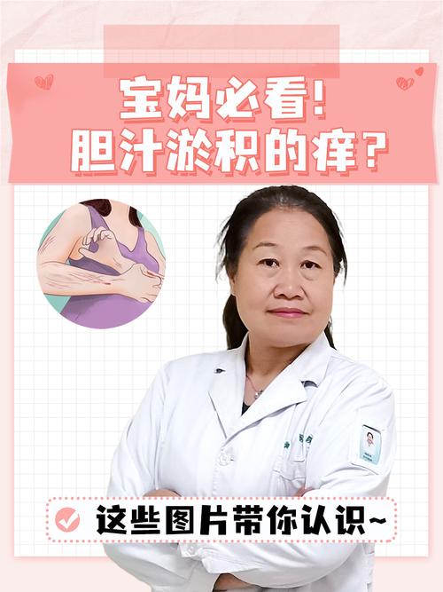 孕期胆汁酸高有哪些症状？-第1张图片-郑州医学网