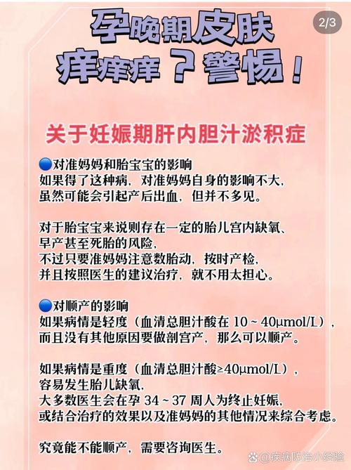 孕期胆汁酸高有哪些症状？-第3张图片-郑州医学网