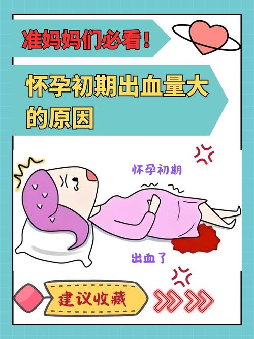 怀孕出血是危险信号吗?原因有哪些?-第1张图片-郑州医学网 怀孕出血是危险信号吗?原因有哪些?-第1张图片-郑州医学网