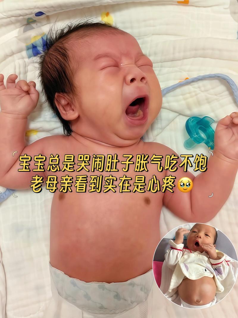 新生儿的肚子都是鼓鼓的吗-第2张图片-郑州医学网 新生儿的肚子都是鼓鼓的吗-第2张图片-郑州医学网