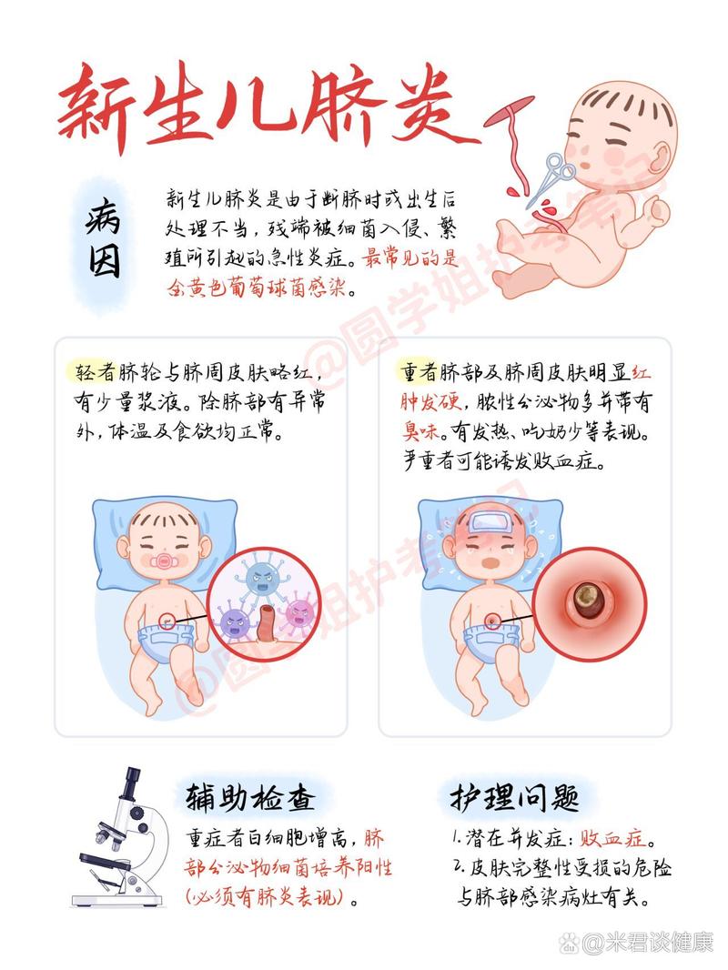 新生儿肚脐出血是什么原因-第2张图片-郑州医学网