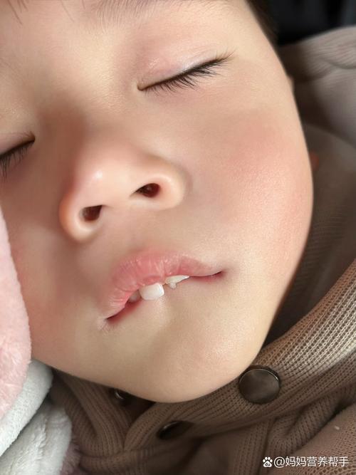 新生儿上唇突出正常吗？-第1张图片-郑州医学网