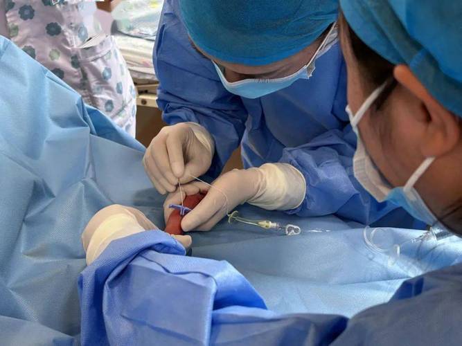 新生儿PICC置管术视频如何规范操作?-第3张图片-郑州医学网 新生儿PICC置管术视频如何规范操作?-第3张图片-郑州医学网
