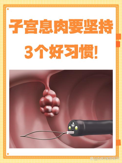 孕期宫颈息肉怎么办?-第1张图片-郑州医学网 孕期宫颈息肉怎么办?-第1张图片-郑州医学网