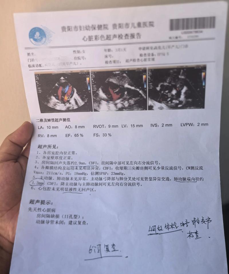 新生儿心脏动脉导管未闭合-第2张图片-郑州医学网