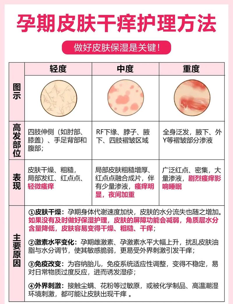 孕期身上发痒怎么办？-第1张图片-郑州医学网