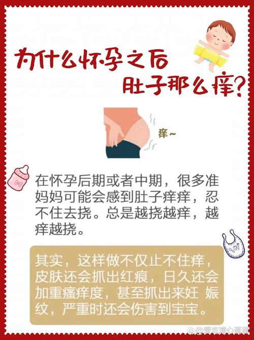 孕期身上发痒怎么办？-第3张图片-郑州医学网