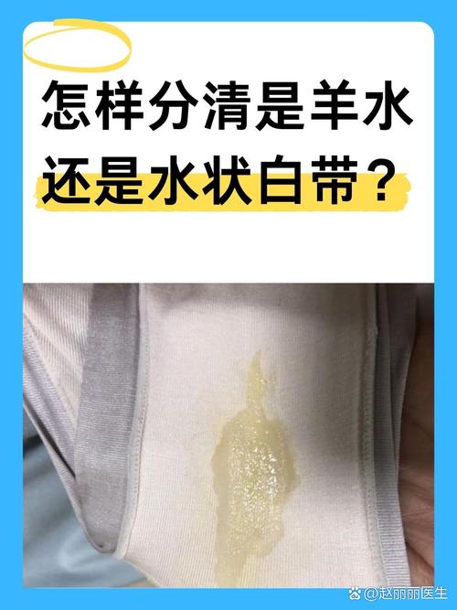 孕期无白带正常吗?-第2张图片-郑州医学网 孕期无白带正常吗?-第2张图片-郑州医学网