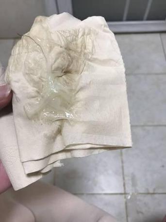 孕期无白带正常吗？-第3张图片-郑州医学网