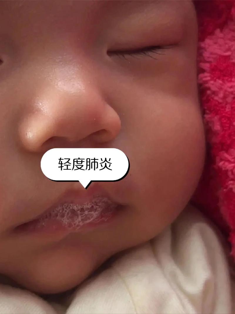 新生儿嘴周围发青怎么回事-第2张图片-郑州医学网
