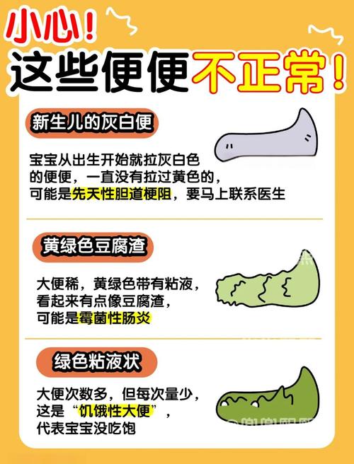 新生儿大便拉不出来怎么办?-第2张图片-郑州医学网 新生儿大便拉不出来怎么办?-第2张图片-郑州医学网