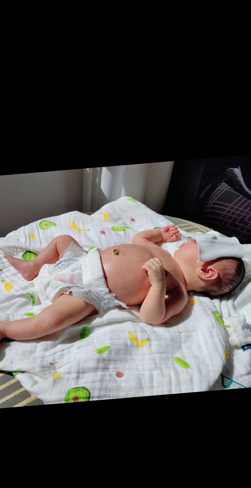 新生儿黄疸一天晒多久太阳-第2张图片-郑州医学网 新生儿黄疸一天晒多久太阳-第2张图片-郑州医学网