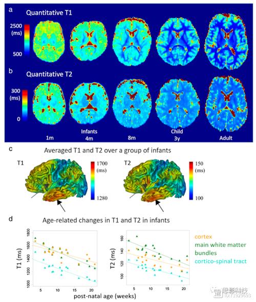 新生儿做核磁共振会影响健康吗?-第3张图片-郑州医学网 新生儿做核磁共振会影响健康吗?-第3张图片-郑州医学网