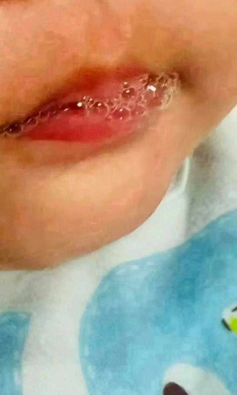 新生儿吐泡泡是正常现象吗？-第1张图片-郑州医学网