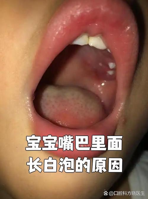 新生儿吐泡泡是正常现象吗？-第3张图片-郑州医学网