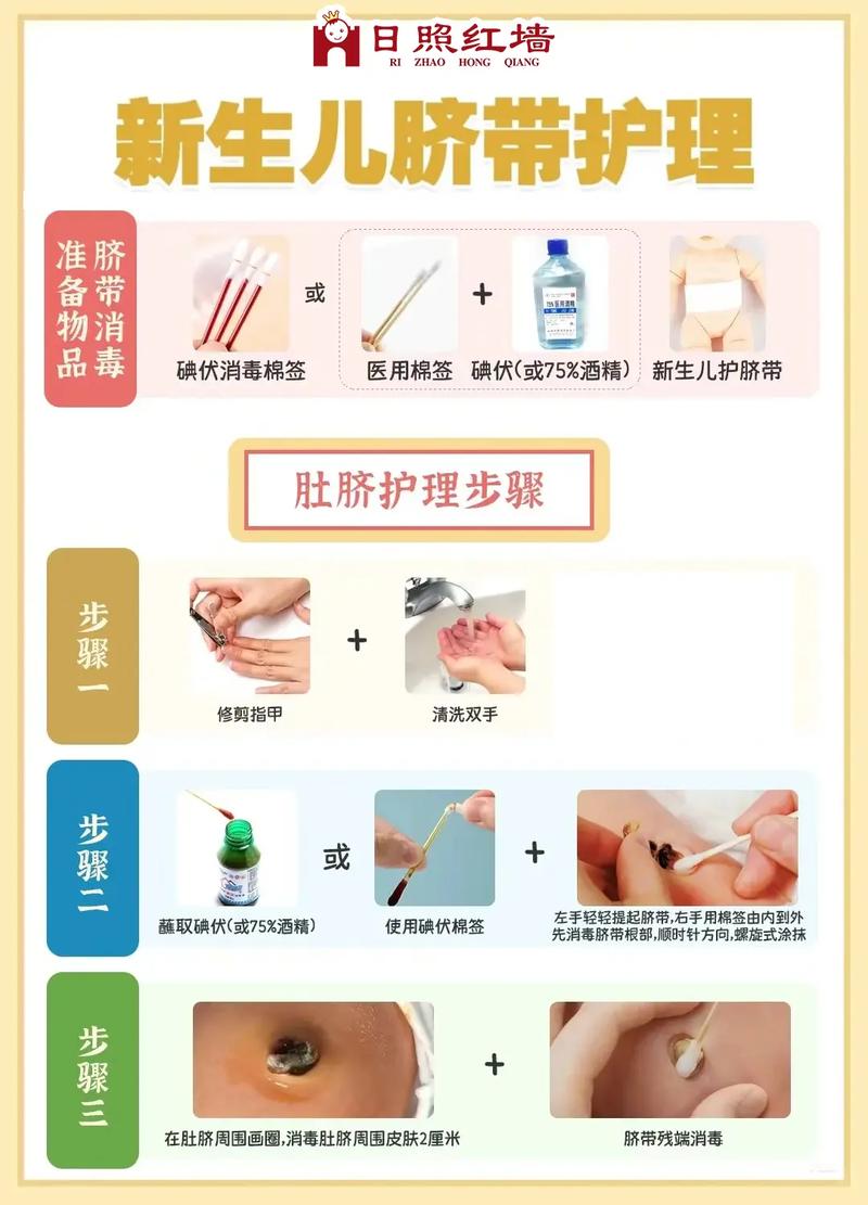 脐带脱落后，护理要注意什么？-第2张图片-郑州医学网