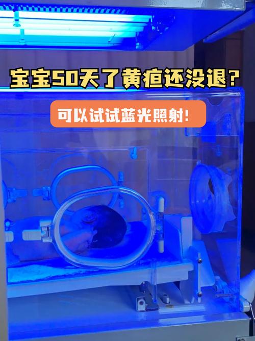 新生儿黄疸值多少必须照蓝光？-第1张图片-郑州医学网