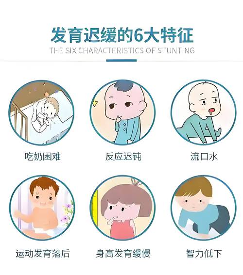 3岁发育迟缓有哪些典型表现?-第2张图片-郑州医学网 3岁发育迟缓有哪些典型表现?-第2张图片-郑州医学网