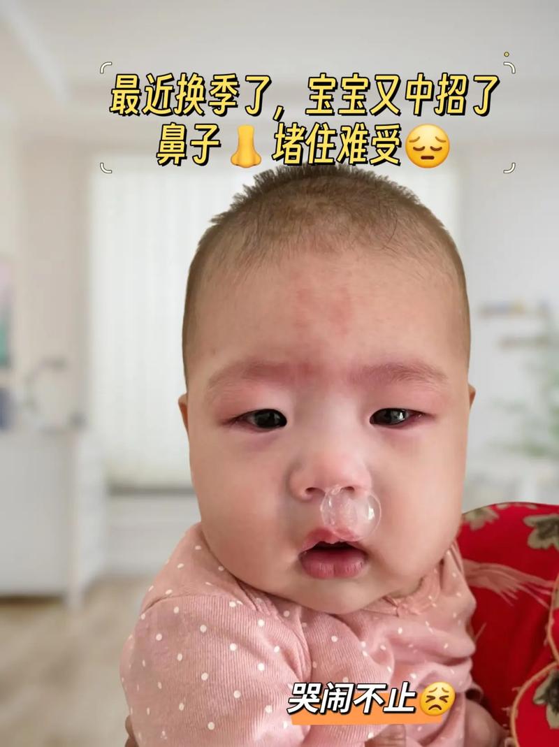 新生儿15天鼻塞鼻涕怎么办？-第2张图片-郑州医学网