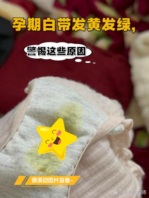 孕期白带黄绿色有异味怎么办?-第1张图片-郑州医学网 孕期白带黄绿色有异味怎么办?-第1张图片-郑州医学网