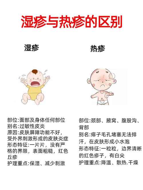 儿童过敏性湿疹怎么治?-第1张图片-郑州医学网 儿童过敏性湿疹怎么治?-第1张图片-郑州医学网