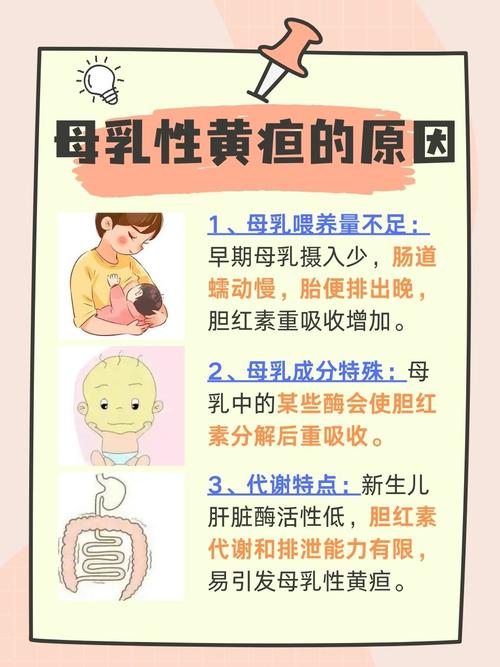新生儿黄疸能喂母乳吗？-第2张图片-郑州医学网