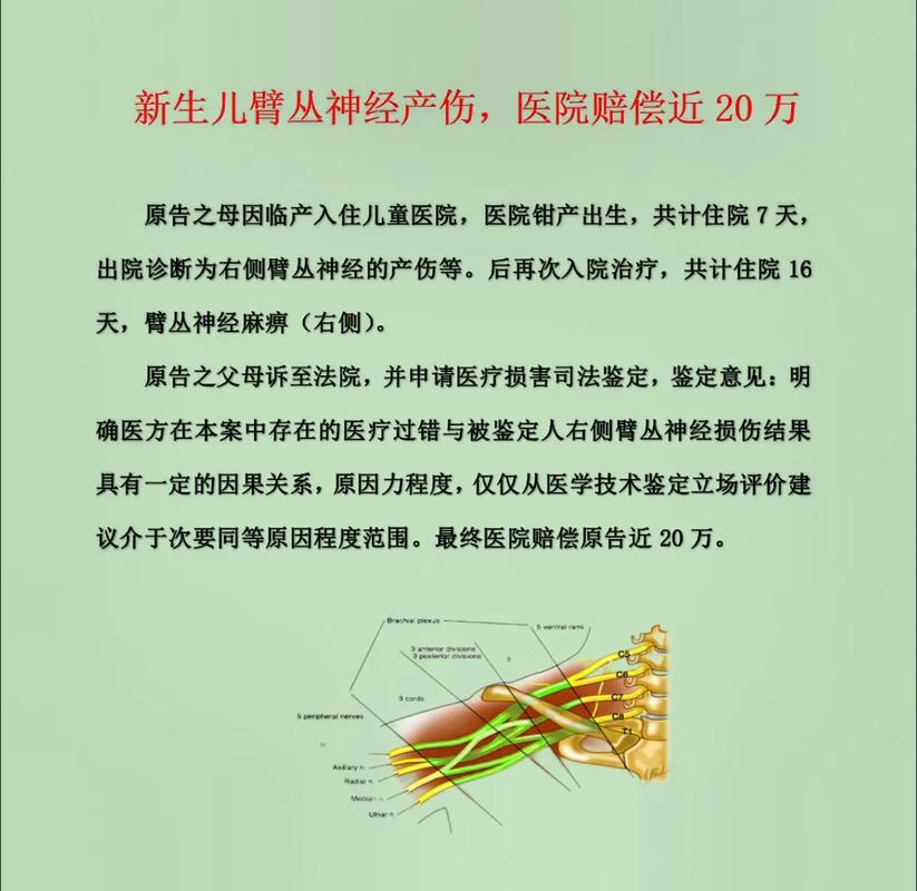新生儿臂丛神经损伤原因-第1张图片-郑州医学网