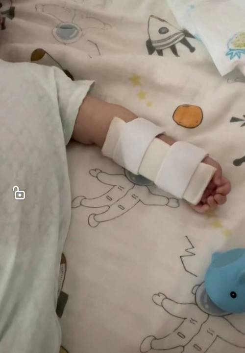 新生儿臂丛神经损伤原因-第2张图片-郑州医学网