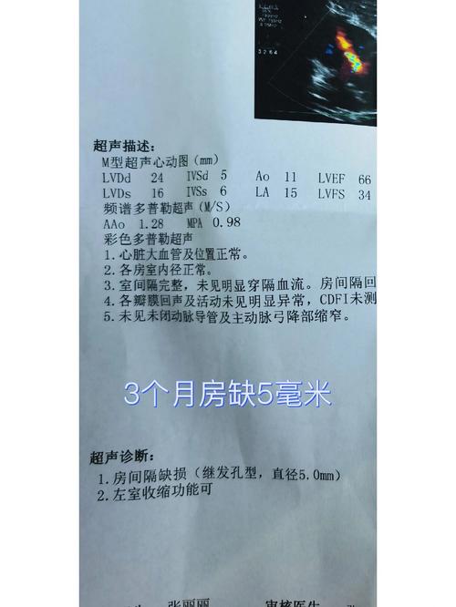 新生儿房间隔缺损能自愈吗？-第1张图片-郑州医学网