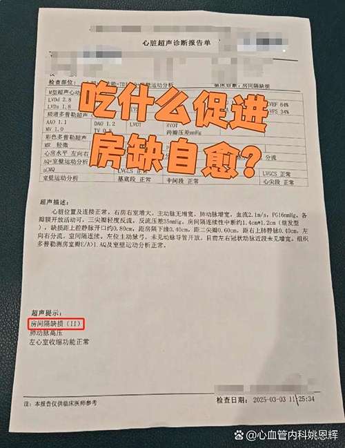 新生儿房间隔缺损能自愈吗？-第3张图片-郑州医学网