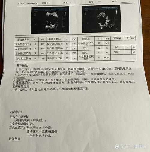 新生儿房间隔缺损能自愈吗？-第2张图片-郑州医学网