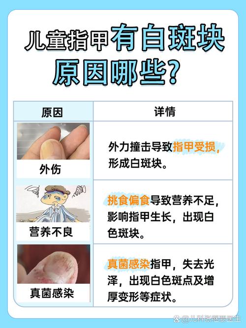 儿童甲减症状有哪些?早识别早治疗很重要-第3张图片-郑州医学网 儿童甲减症状有哪些?早识别早治疗很重要-第3张图片-郑州医学网