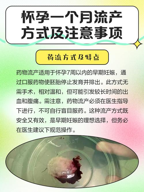 孕期出血就一定会流产吗？-第1张图片-郑州医学网