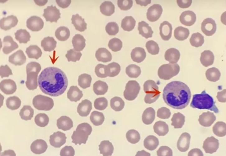 孕期中性粒细胞比率高-第2张图片-郑州医学网 孕期中性粒细胞比率高-第2张图片-郑州医学网