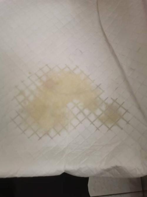 怀孕期间乳房有水出来-第3张图片-郑州医学网