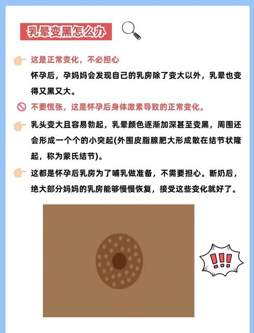 怀孕后乳晕颜色为何会变浅?-第1张图片-郑州医学网 怀孕后乳晕颜色为何会变浅?-第1张图片-郑州医学网