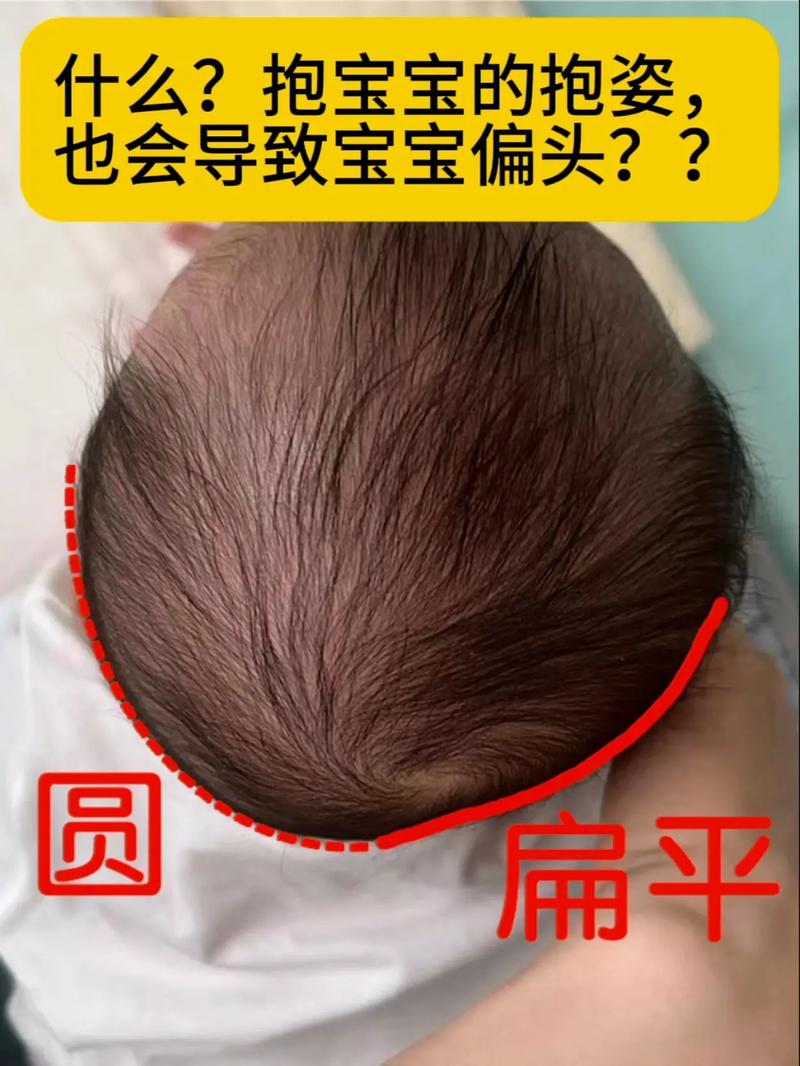 孕期头偏大怎么办？需要干预吗？-第1张图片-郑州医学网