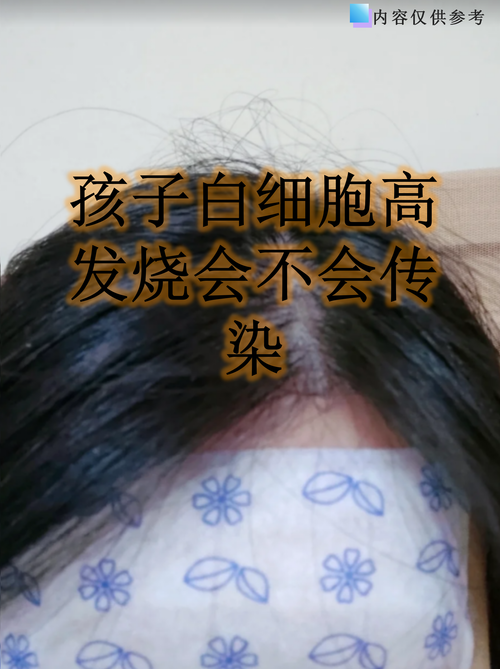 新生儿白细胞高怎么办?-第2张图片-郑州医学网 新生儿白细胞高怎么办?-第2张图片-郑州医学网