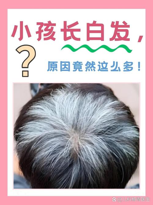 儿童白发是缺营养还是生病了?-第1张图片-郑州医学网 儿童白发是缺营养还是生病了?-第1张图片-郑州医学网