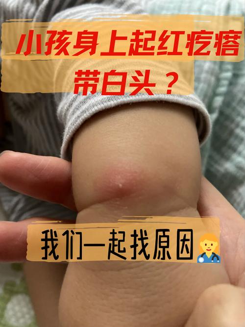 儿童白发是缺营养还是生病了？-第2张图片-郑州医学网