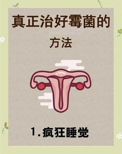 孕期霉菌痒难忍？怎么办？-第2张图片-郑州医学网