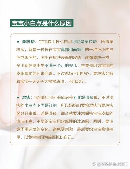新生儿白点是啥原因?-第1张图片-郑州医学网 新生儿白点是啥原因?-第1张图片-郑州医学网