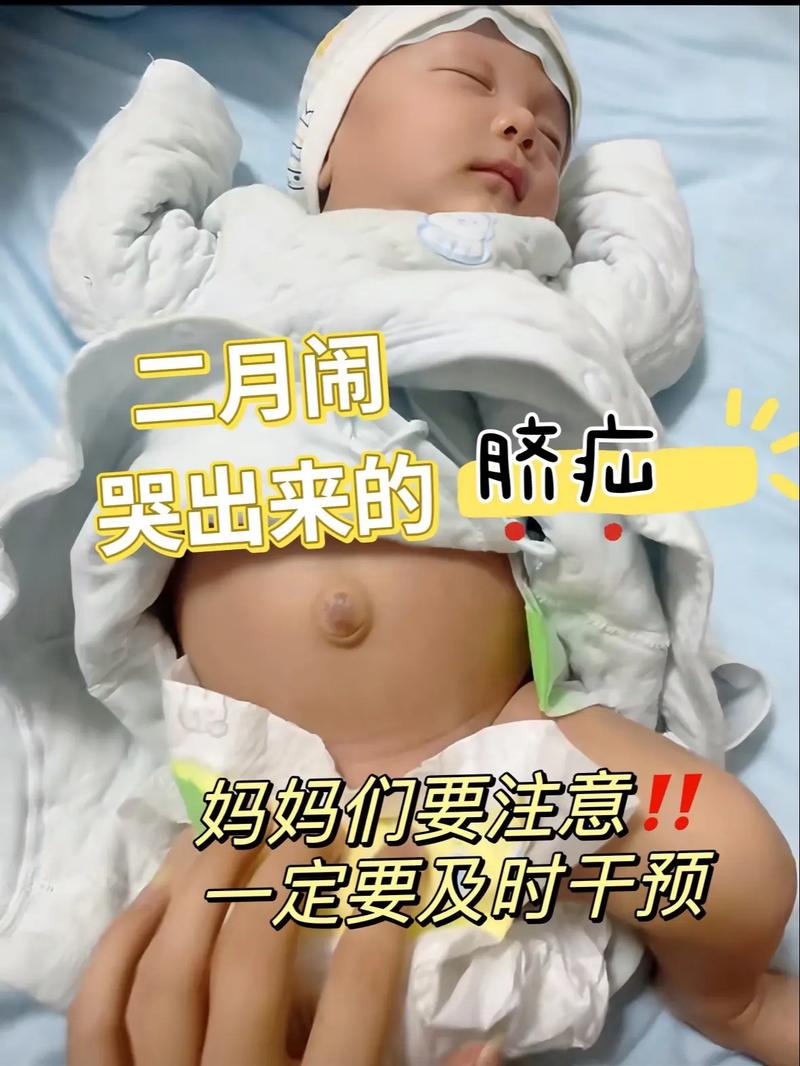 新生儿肚脐高是什么原因？-第3张图片-郑州医学网