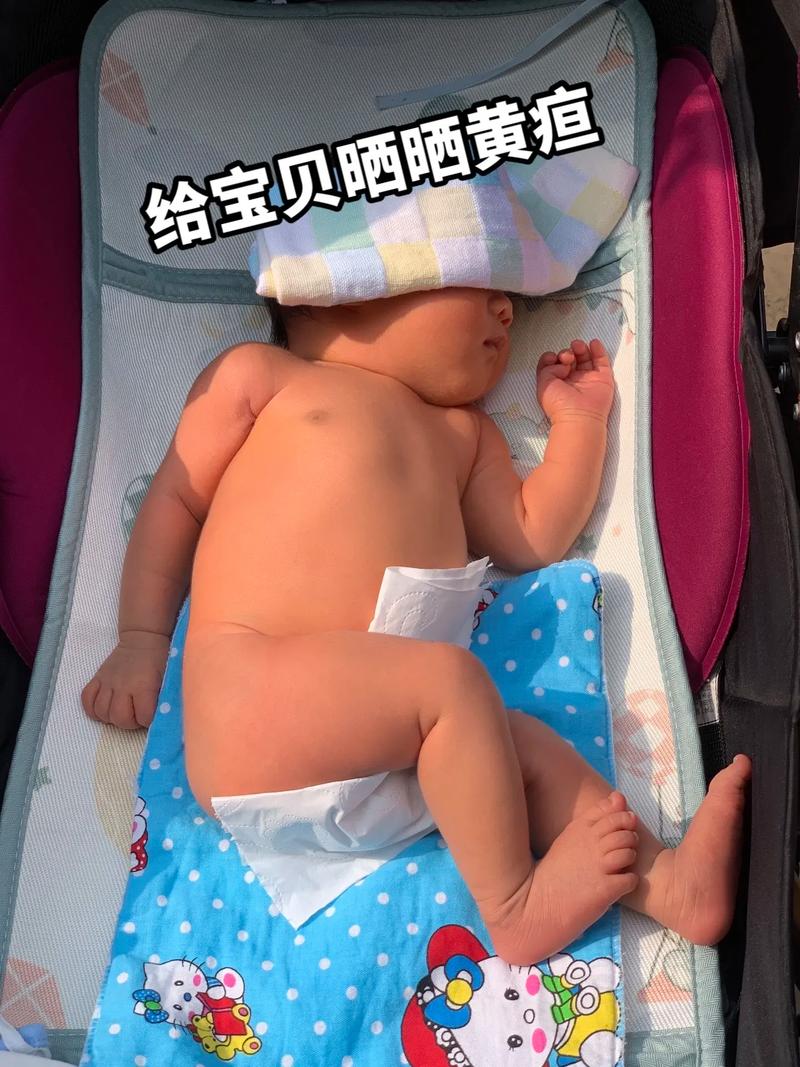 新生儿黄疸20天未退，是病理性黄疸吗？需要怎么处理？-第2张图片-郑州医学网