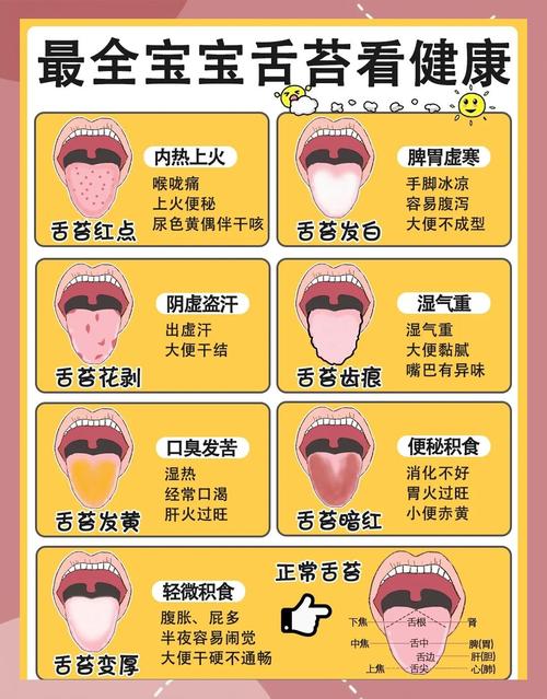 新生儿舌苔发白是正常现象还是健康预警？需要处理吗？-第1张图片-郑州医学网