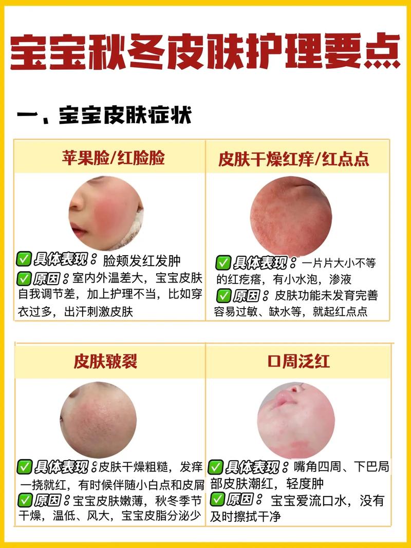 新生儿脸上起红点别慌！是湿疹、热疹还是过敏？正确处理与护理指南-第2张图片-郑州医学网