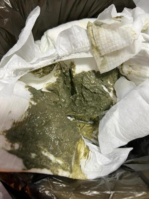 新生儿宝宝大便有点绿是消化不良还是其他原因？-第1张图片-郑州医学网