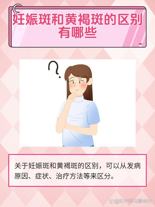 怀孕期间怎样不长斑点？有哪些科学方法能预防孕期色斑形成？-第1张图片-郑州医学网