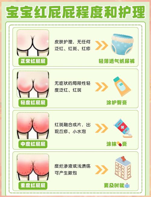 新生儿打屁多是消化不良还是正常生理现象？-第1张图片-郑州医学网